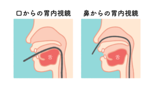 経口内視鏡・経鼻内視鏡を選択可能