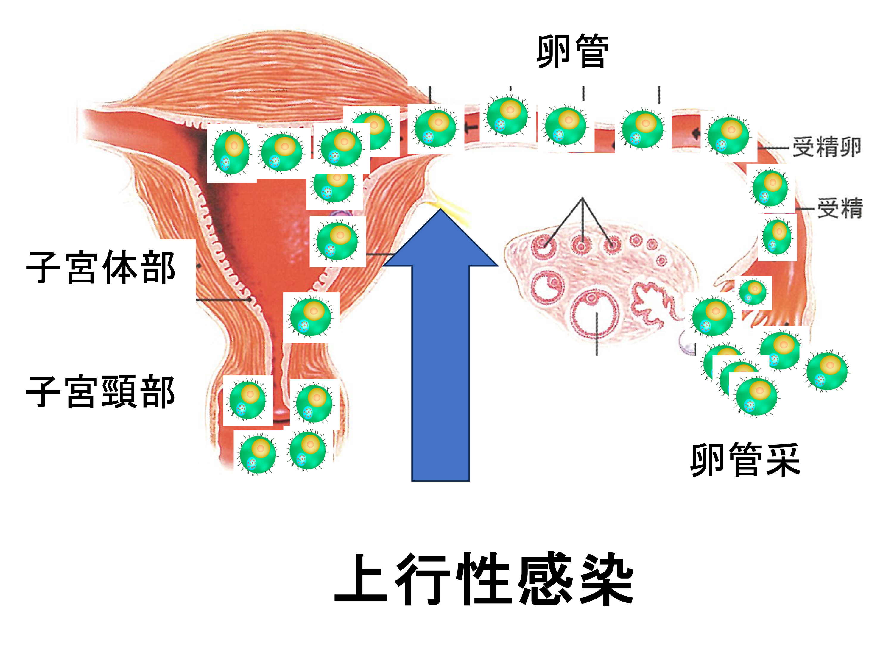 性感染症