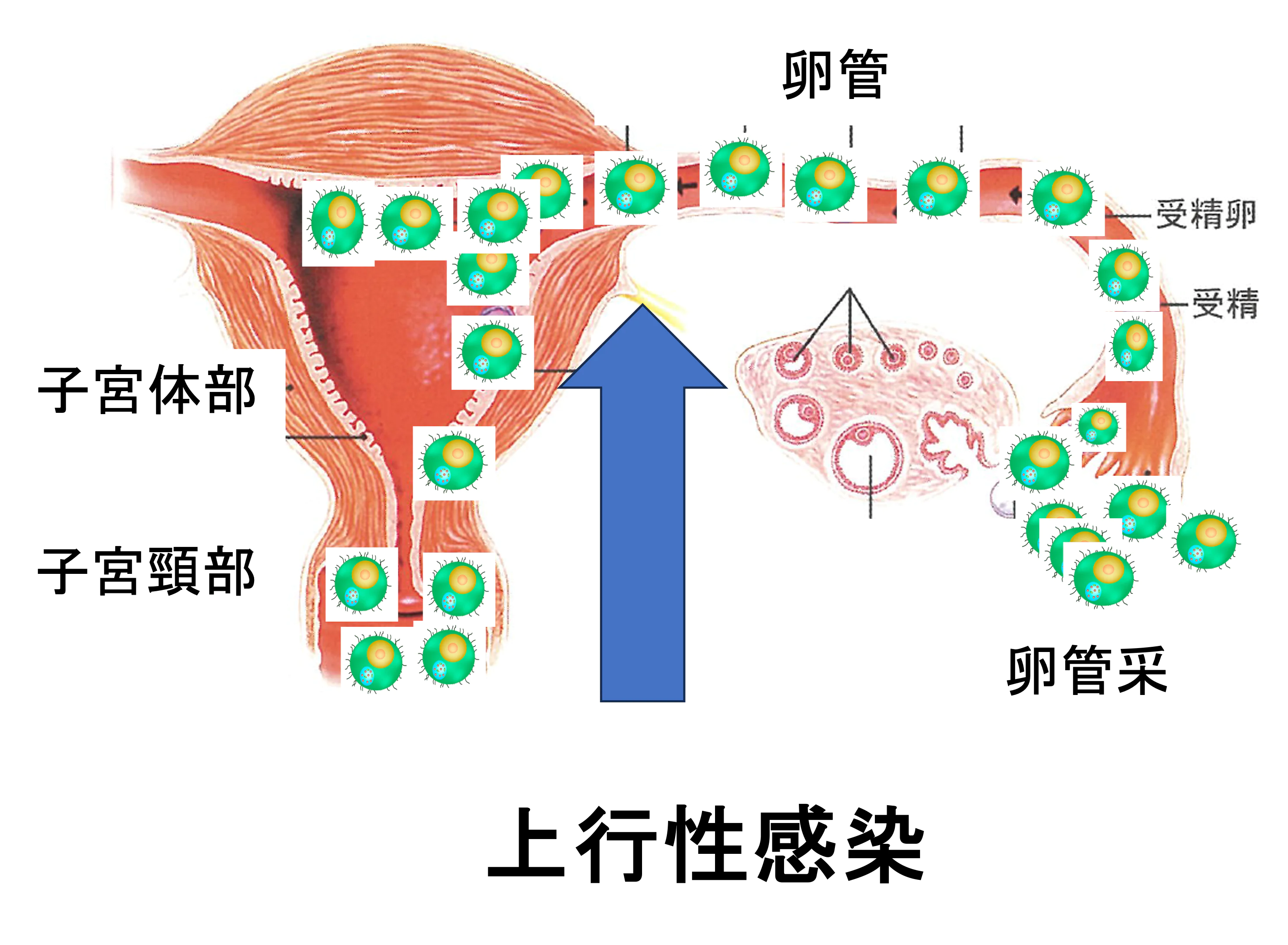 性感染症